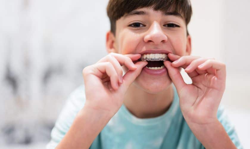 The Importance Of Early Orthodontic Treatment For Children